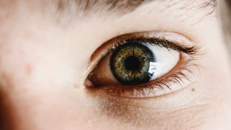 Hur får man försäkring för att betala för ögonlockskirurgi? 3 översta villkoren!