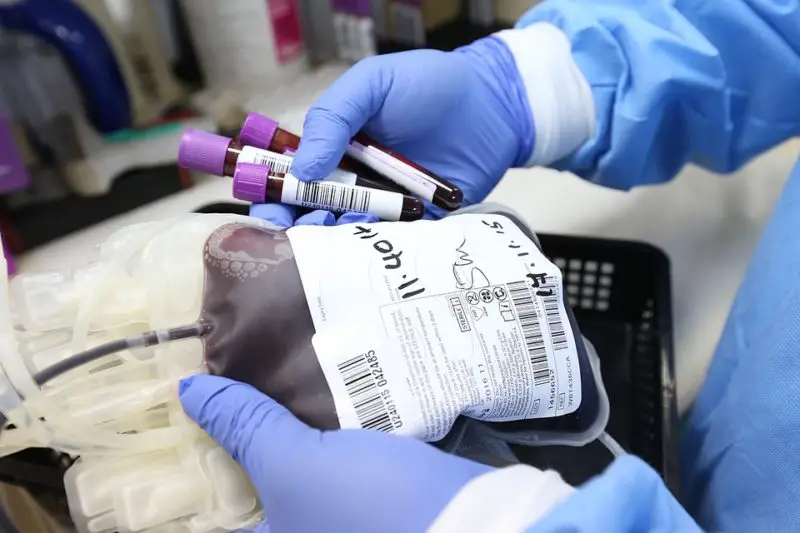 Hur sänker man hematokrit för plasmadonation? 6 fantastiska sätt!