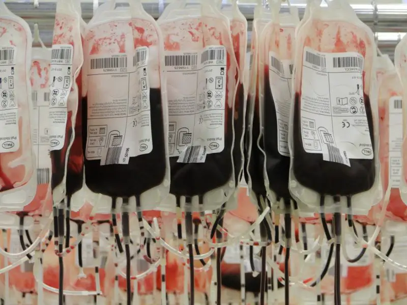 Vad är dubbeldonation av röda blodkroppar? 3 överraskande sjukdomar kopplade till RBC!